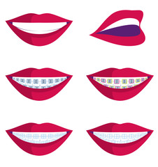 Obraz premium vector illustration of smiles with different types of braces