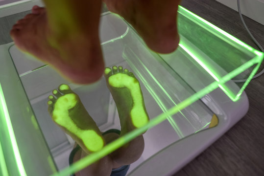 Crop person standing on modern scanning equipment during diagnostics and consultation with podiatry doctor