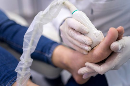 Crop podiatry doctor in protective gloves using ultrasound diagnostic equipment while examining feet of patient in clinic