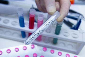 epidemic test and analysis coronavirus, a vaccine and a cure for the virus appeared in Wuhan, China