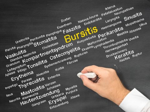 Bursitis