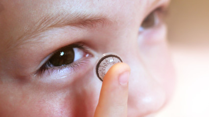 Children's vision. Colored contact lenses and a child.