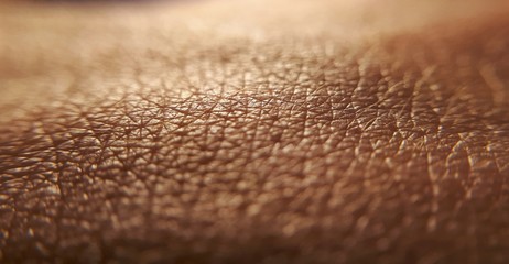 Skin diseases concept. macro skin of human hand.Medicine and dermatology concept. Details of human skin background. - obrazy, fototapety, plakaty