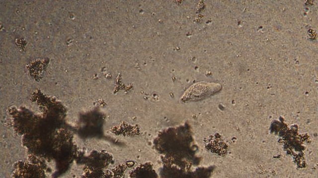 Microscopy of Amoeba limax in the water (pond) sample. Magnification 300x microorganism in active movement.