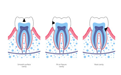 Vector isolated illustration of tooth 