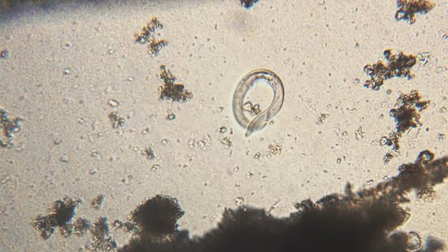 Microscopy of parasite worm nematode (Strongyloides stercoralis). Movement of active parasite infection form in magnification 150x.