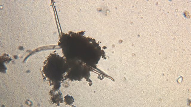 Microscopy of parasite worm nematode (Strongyloides stercoralis). Movement of active parasite infection form in magnification 150x.