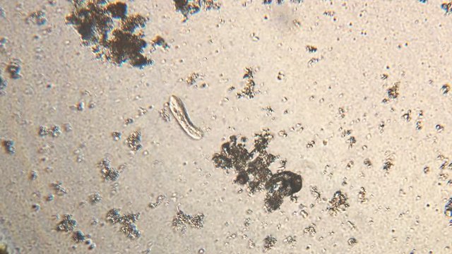 Microscopy of protozoa ciliate and small microorganisms in the water sample. Magnification 150x infusoria under microscope in active movement and feed process.