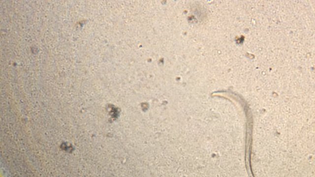 Microscopy of parasite worm nematode (Strongyloides stercoralis). Movement of active parasite infection form in magnification 150x.