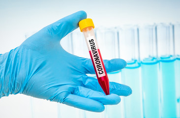 Test-tube with positive blood test on CORONAVIRUS