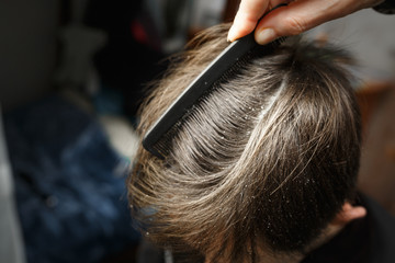 Obraz premium dandruff on the head of dark-haired guy