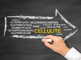 Cellulite