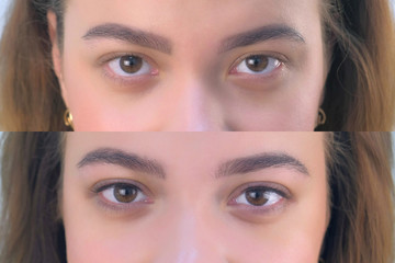 Eyes of beautiful young girl before and after beauty procedure of permanent eyeliner in cosmetology clinic. Eyes closeup view. Woman is looking at camera, front view. - obrazy, fototapety, plakaty