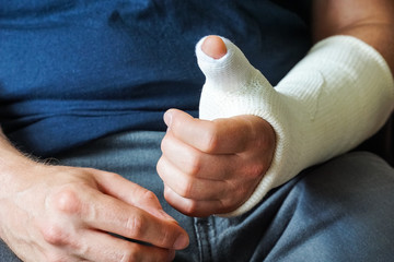 Man with plaster cast on broken hand, broken thumb,broken wrist