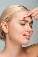Naklejka premium displeased and naked girl touching face with red pimples isolated on grey