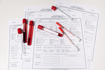 Test tubes with blood. nCov, Coronavirus test
