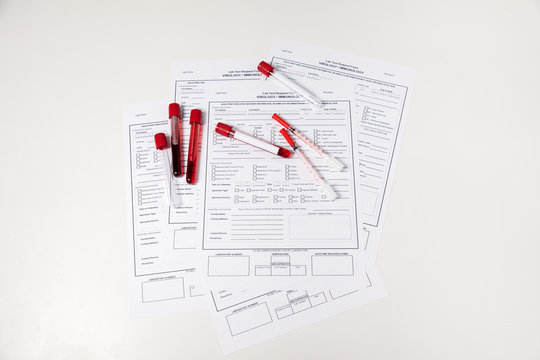 Test tubes with blood. nCov, Coronavirus test