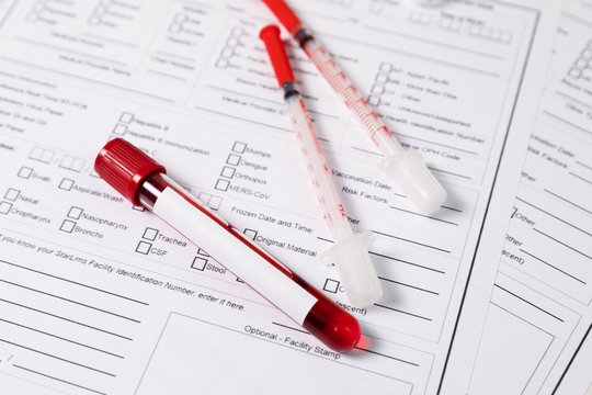 Test tubes with blood. nCov, Coronavirus test