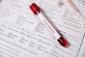 Fototapeta premium Test tubes with blood. nCov, Coronavirus test
