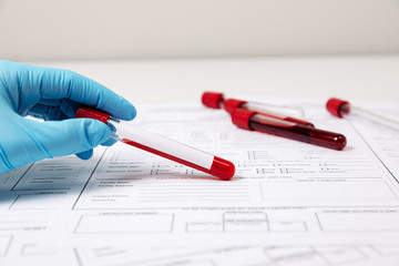 Doctor's hand with blood probe. Coronavirus test