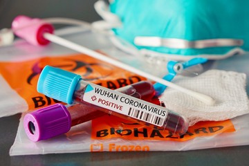 Positive blood test and swab result for the new rapidly spreading Coronavirus, originating in Wuhan, China with a respirator mask and biohazard bags 