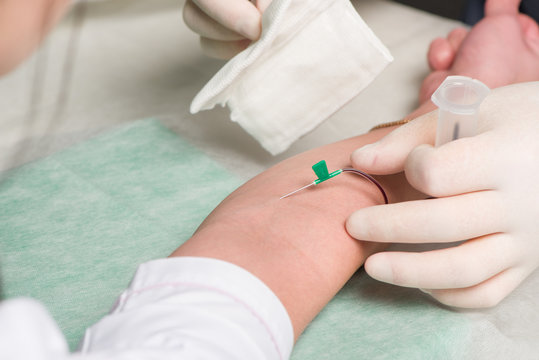 Hand in latex medical gloves perform vein puncture in area of ulnar bend of patient 's hand