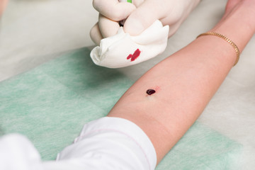 Male hands in medical gloves process site of vein puncture in area of ulnar bend of patient 's hand