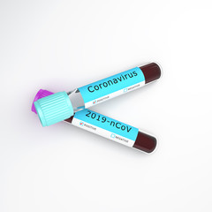 Coronavirus 2019-nCoV blood test tube on studio lighting white background, 3D rendering illustration.
