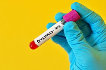 Obraz premium Test tube with blood sample for coronavirus test