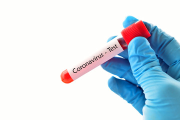 Obraz premium Test tube with blood sample for coronavirus test