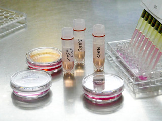 New coronavirus 2019-nCoV in laboratory