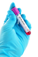 Blood sample tube positive with 2019-nCoV, novel coronavirus 2019 found in Wuhan, China