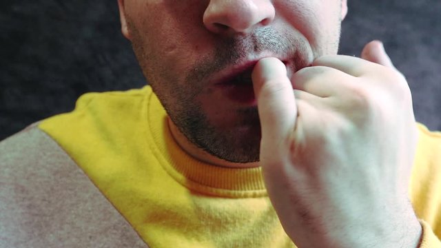 Ugly ugryzienie fingers, biting nails, cuticles, wounds on the fingers. Nail-biting habit. The concept of onychophagy. unattended nail, cracked skin, bad nail grooming.