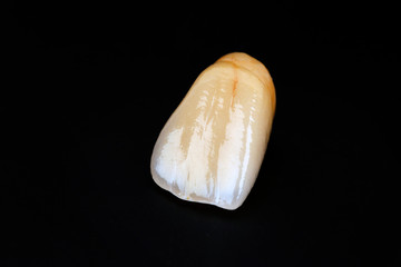 dental ceramic crowns, natural color effects