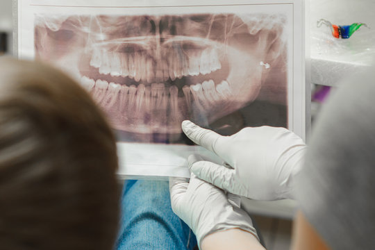 An orthodontist doctor shows the boy an x-ray of his teeth.