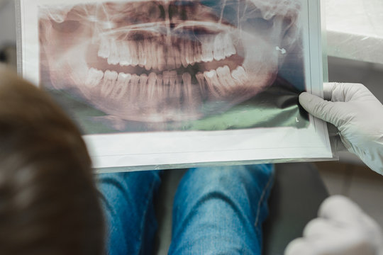 An orthodontist doctor shows the boy an x-ray of his teeth.