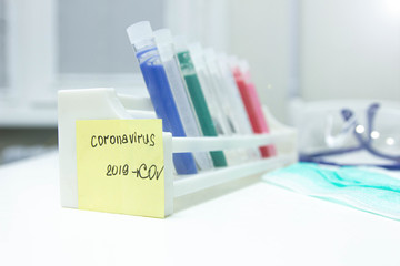 test tube coronavirus, experiments in search of a vaccine.