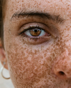  Freckle Images – Browse 172,851 Stock Photos, Vectors, and Video ...
