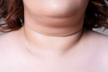 Flabby skin on the neck of an fat woman, female double chin on gray background - obrazy, fototapety, plakaty