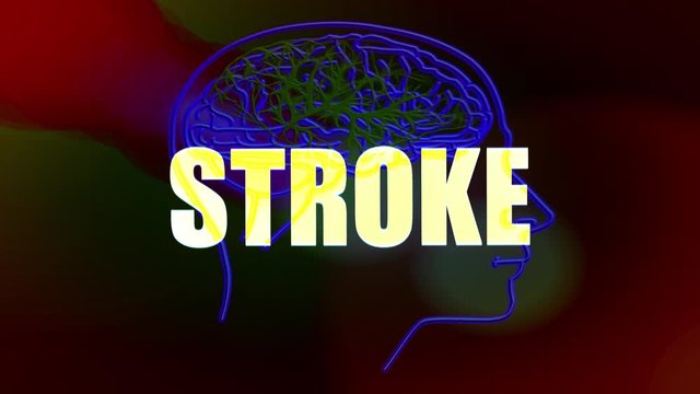 STROKE title intro animated with a background showing a human brain with blue red vessels anatomy.