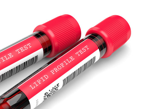 3d render with lipid profile test blood samples