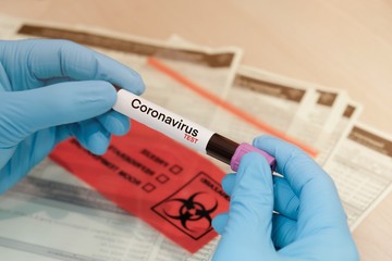 Coronavirus blood test in hospital laboratory
