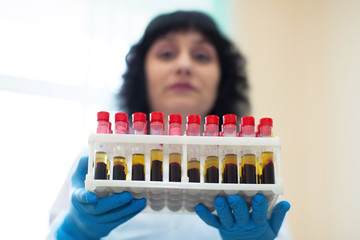  Blood transfusion station.Nurse with blood tests.Blood in test tubes.