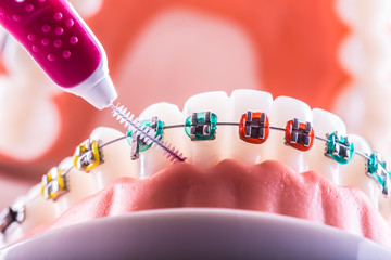 Tooth model from dental braces with inter dental teeth cleaning brush