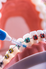 Tooth model from dental braces with inter dental teeth cleaning brush