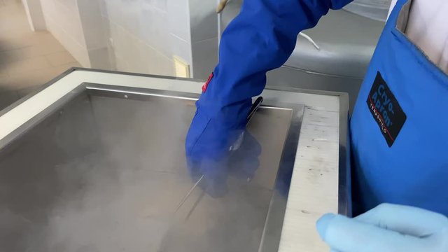 Frozen stem cells are removed from the container with nitrogen