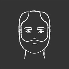 Male hair chalk white icon on black background. Man with alopecia. Hairloss problem. Baldness spot. Dermatology and haircare treatment. Thinning hairline. Isolated vector chalkboard illustration