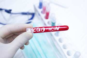 epidemic test and analysis coronavirus 2019-nCoV, a vaccine and a cure for the virus appeared in Wuhan, China