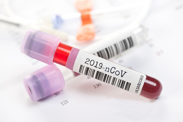 2019-nCoV Novel Coronavirus Blood Test