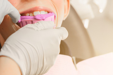 Registration of impressions and bites in a young teenager. Functional modern dental diagnostics.